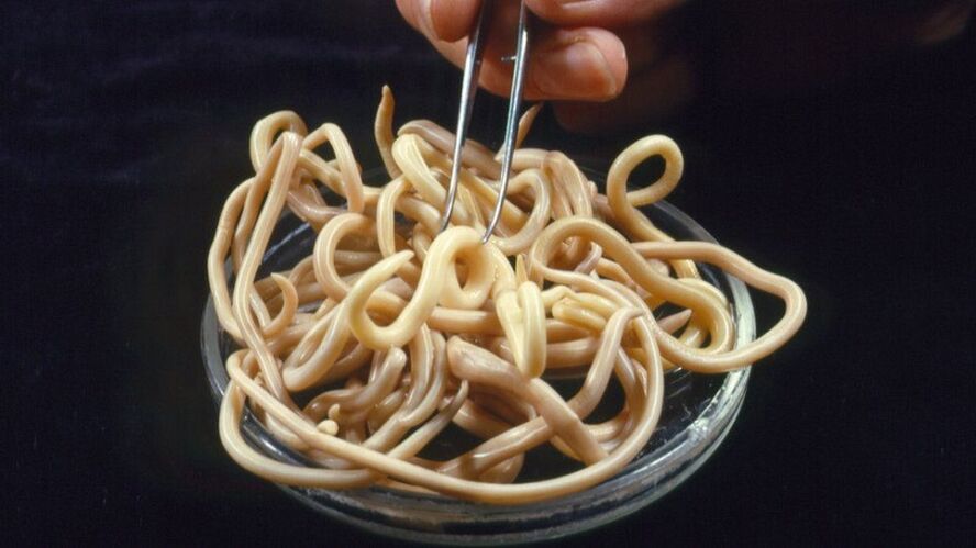 parassiti dal corpo umano