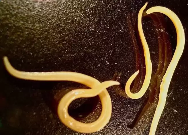 parassita protozoario del corpo umano